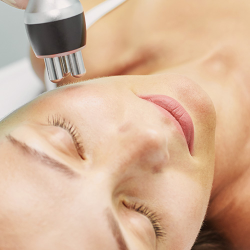 skin cta 4 Microdermabrasion treatment on woman's face