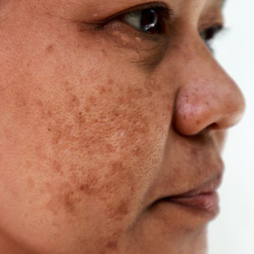 Untitled design (37) Untitled design (37)